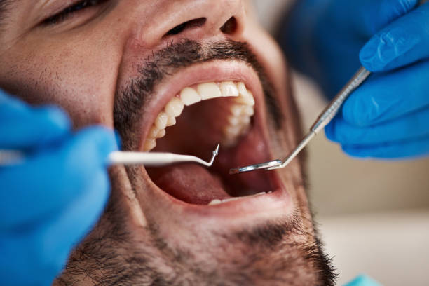 Best Emergency Gum Pain Relief  in Troutdale, OR