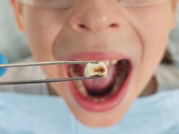Best Knocked-Out Tooth Emergency  in Troutdale, OR